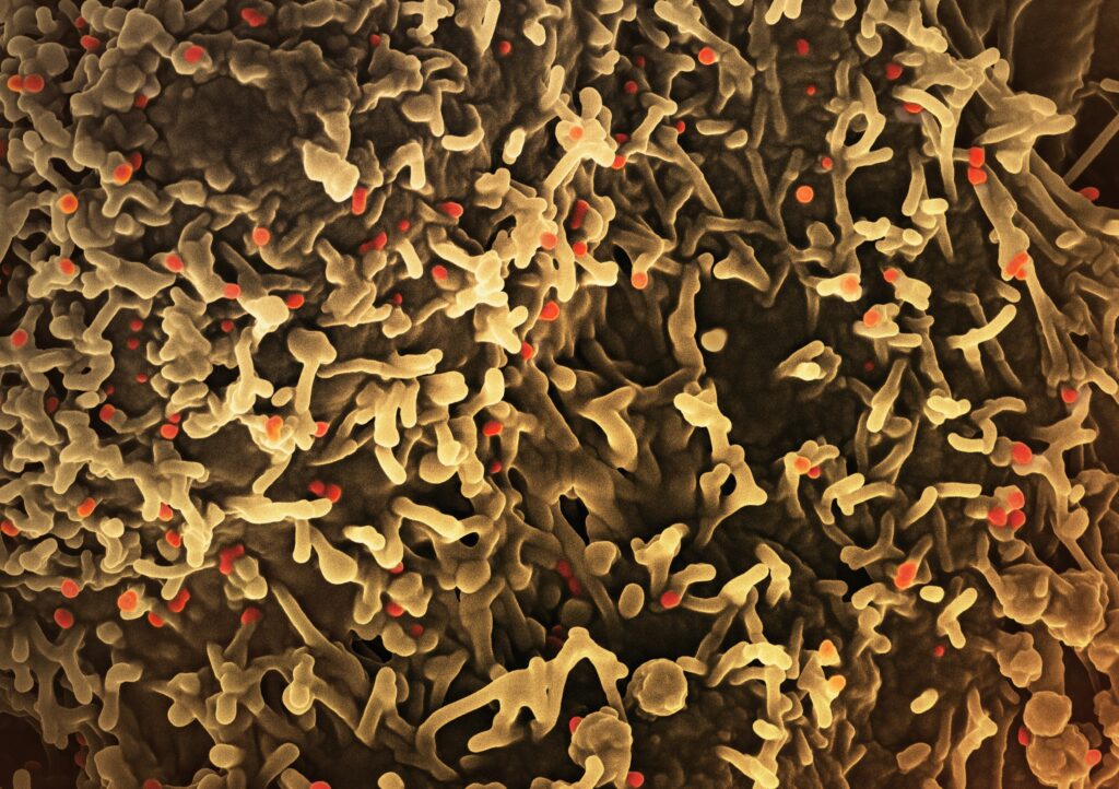 Mpox, noul COVID? Reacția unui oficial al Organizaţiei Mondiale a Sănătăţii Sursa foto: unsplash.com