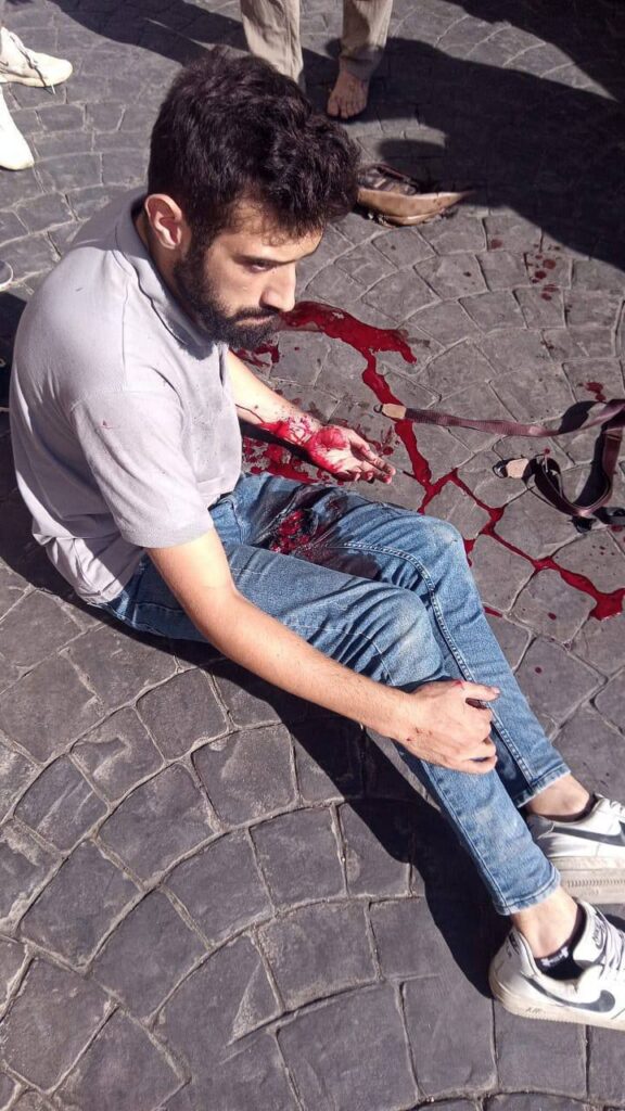 Noi dispozitive au explodat în Liban. După pagere, acum, stații de emisie-recepție