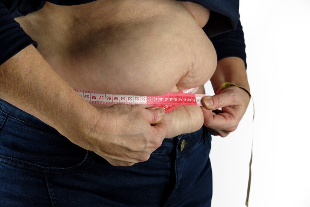 Date alarmante. Patru milioane de români suferă de obezitate